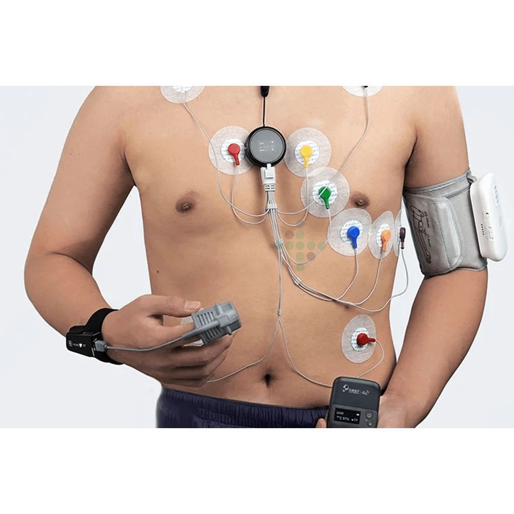 Monitorovací systém EKG Holter M5 - Obrázek 5