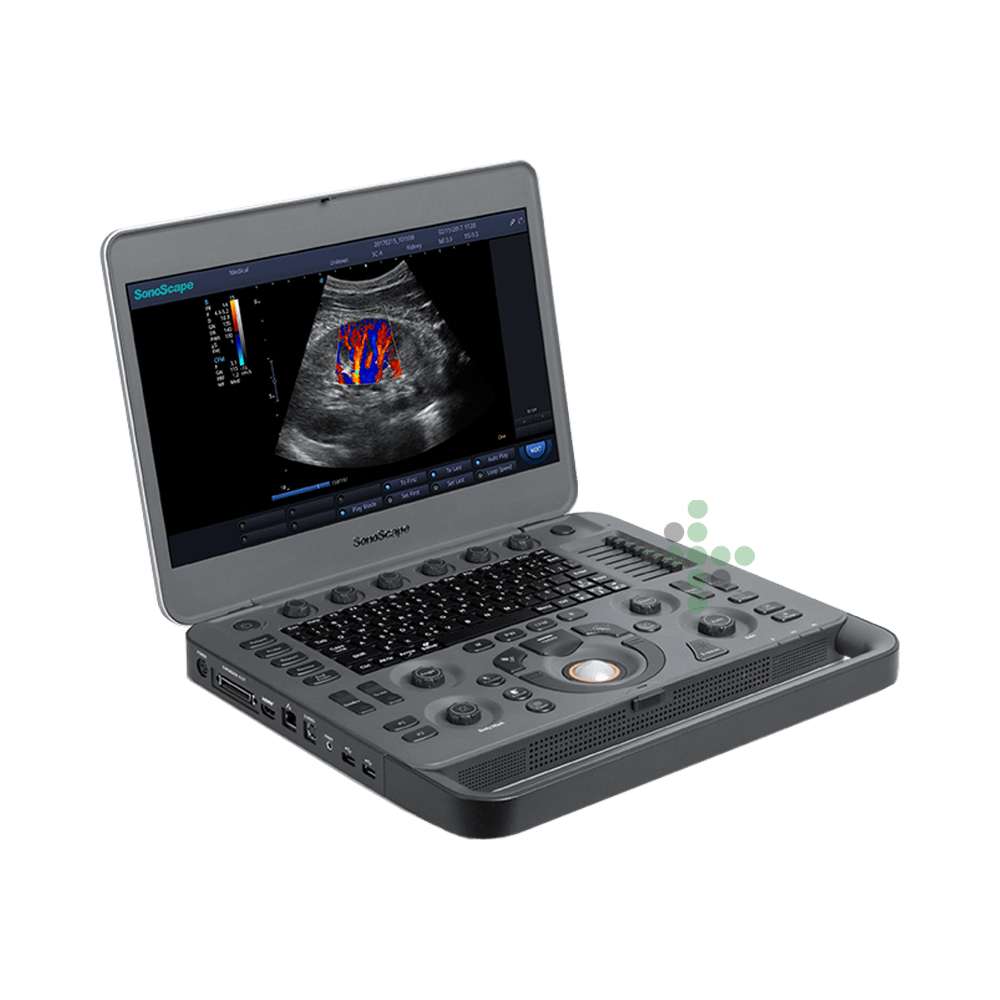 496103 Urządzenie ultradźwiękowe SonoScape X3 - Obraz 1