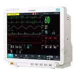 Viacparametrový pacientsky monitor C86