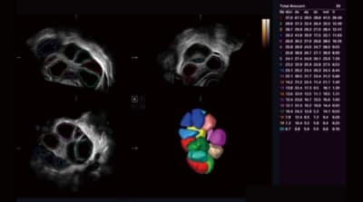 P40 Elite 011 400x223 1