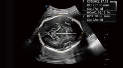 P40 Elite 06 400x223 1