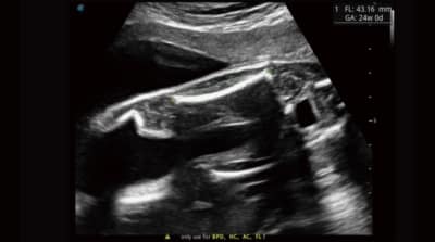 P40 Elite 07 400x223 1