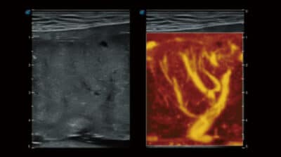 P50 Elite 08 600x334 1