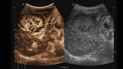 P50 Elite 10 600x334 1