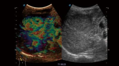 P50 Elite 11 600x334 1