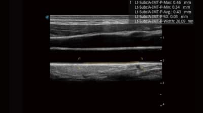 P40 Elite 010 400x223 1