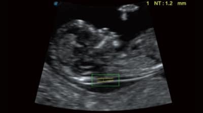 P40 Elite 08 400x223 1