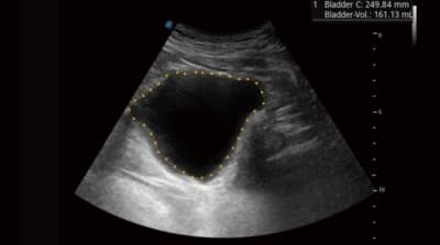 P40 Elite 09 400x223 1