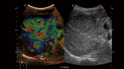 P50 Elite 11 600x334 1