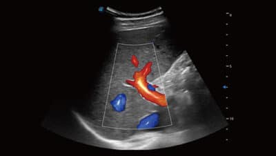 Bright Flow%E2%80%8B 1