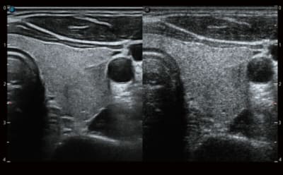 P40 Elite 04 400x248 1