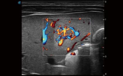 P40 Elite 05 400x248 1