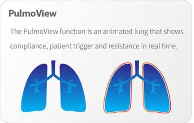 Funkcia viacnasobneho monitorovania