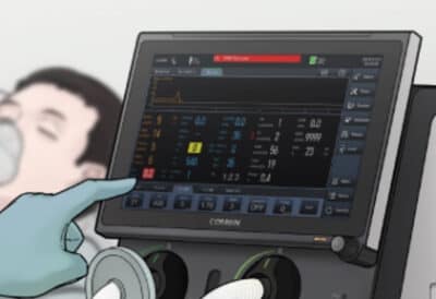 Neinvazivna liecba %E2%80%93 NIV a O2 terapia 3