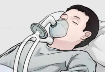 Neinvazivna liecba %E2%80%93 NIV a O2 terapia