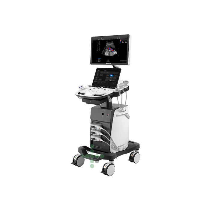 Ultrazvukový přístroj SonoScape P9 Elite - Obrázek 1