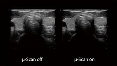 %CE%BC Scan