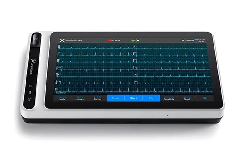 portable 12 lead ecg monitor